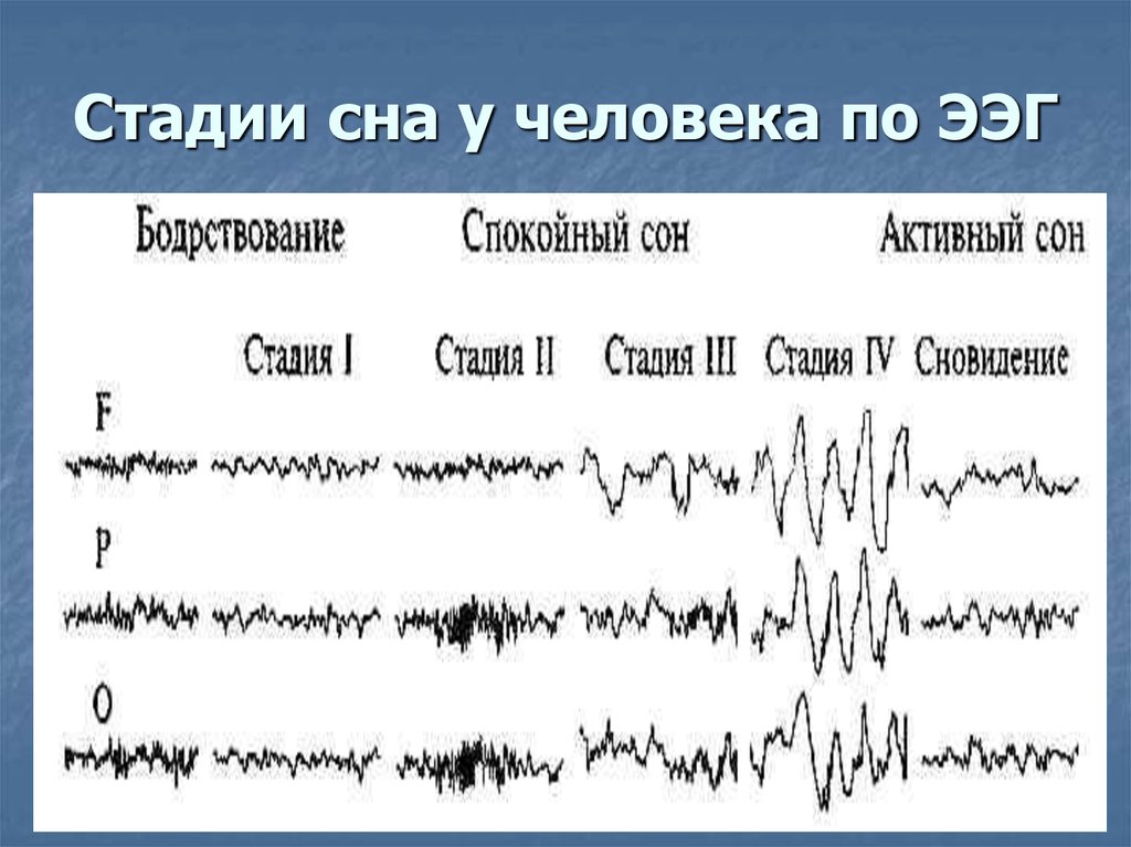 Фазы сна человека. Стадии сна параметры ЭЭГ. Фазы сна ЭЭГ. Фазы медленного сна ЭЭГ. ЭЭГ сна ритмы.