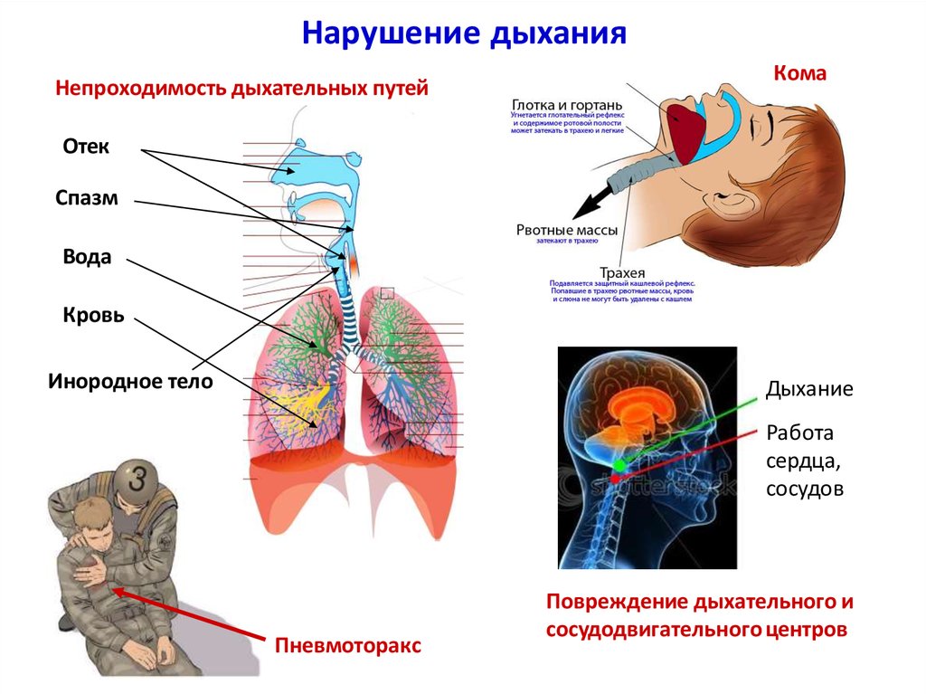 Презентация на тему болезни верхних дыхательных путей