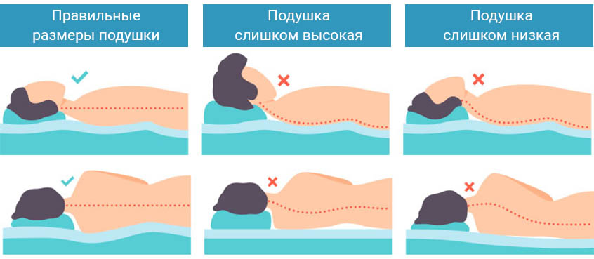 Остеохондроз спать без подушки. Правильная подушка для сна при шейном остеохондрозе. Правильное положение головы во время сна при шейном остеохондрозе. Правельное положения головы на подушке. Правильное положение головы во сне.