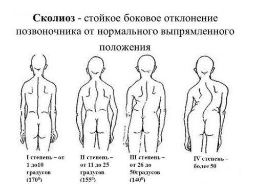 Как правильно плавать в бассейне для позвоночника