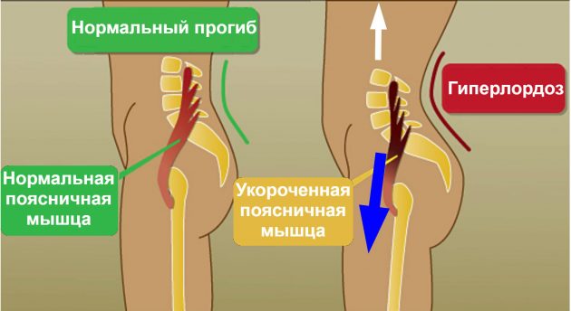 продольный шпагат: поясничная мышца