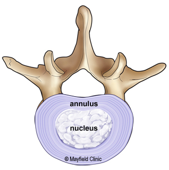 Illustration of intervertebral disc