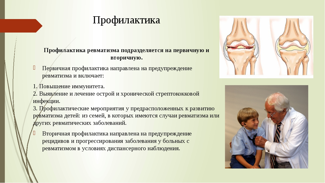 Школа для пациентов с заболеваниями суставов и позвоночника презентация