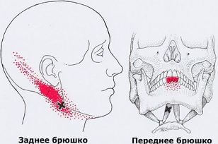 Триггеры: Карта точек боли и напряжения в теле 