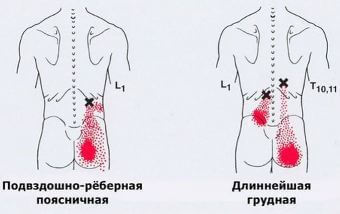 Триггеры: Карта точек боли и напряжения в теле 