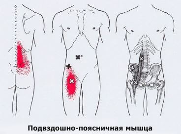 Триггеры: Карта точек боли и напряжения в теле 