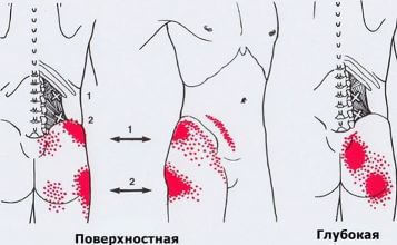 Триггеры: Карта точек боли и напряжения в теле 