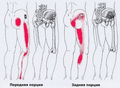 Триггеры: Карта точек боли и напряжения в теле 