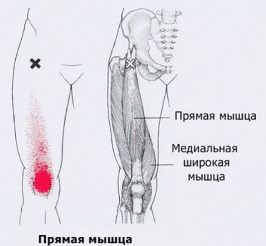 Триггеры: Карта точек боли и напряжения в теле 