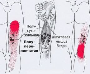 Триггеры: Карта точек боли и напряжения в теле 