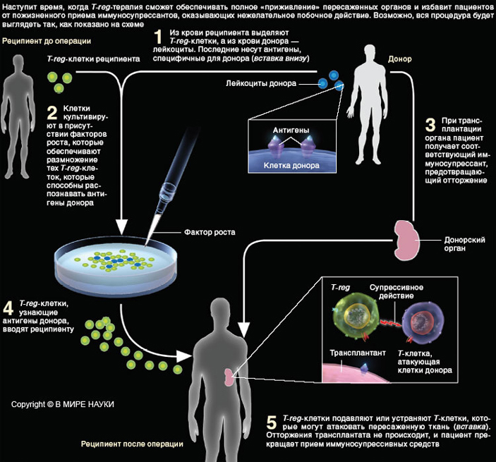 Будущее трансплантологии (изображение с сайта www.sciam.ru)