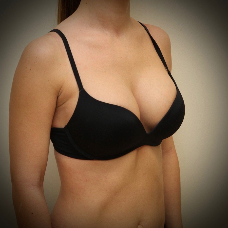 Размер женской груди второго размера фото