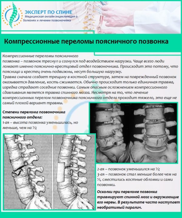 Компрессионные переломы поясничного позвонка