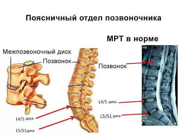 Поясничный отдел позвоночника