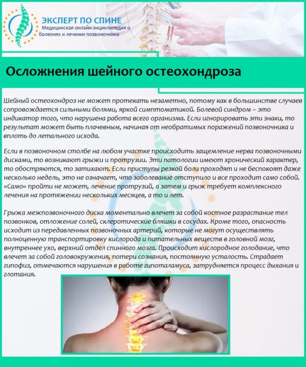 Осложнения шейного остеохондроза