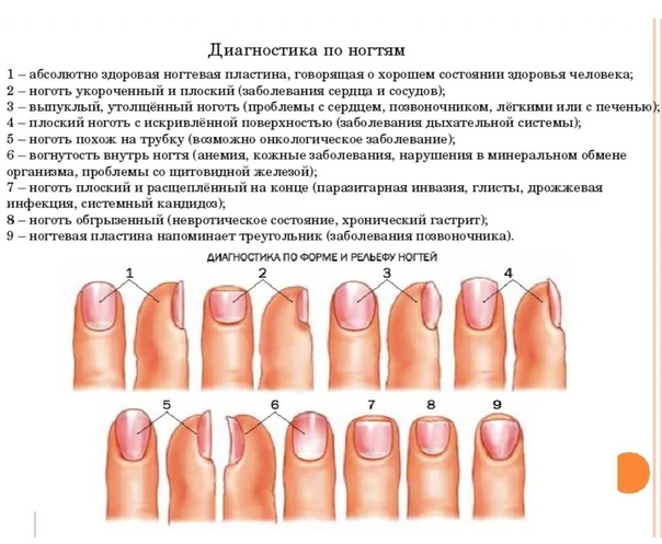 Как по ногтям определить заболевание организма фото с описанием в домашних условиях для женщин