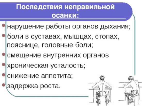 Последствия неправильной осанки