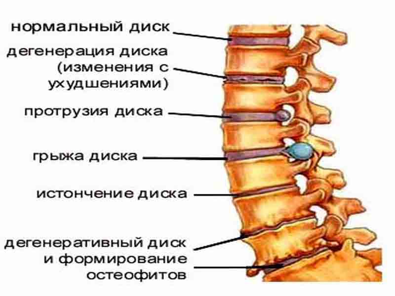 Позвоночник человека: за что отвечает каждый позвонок