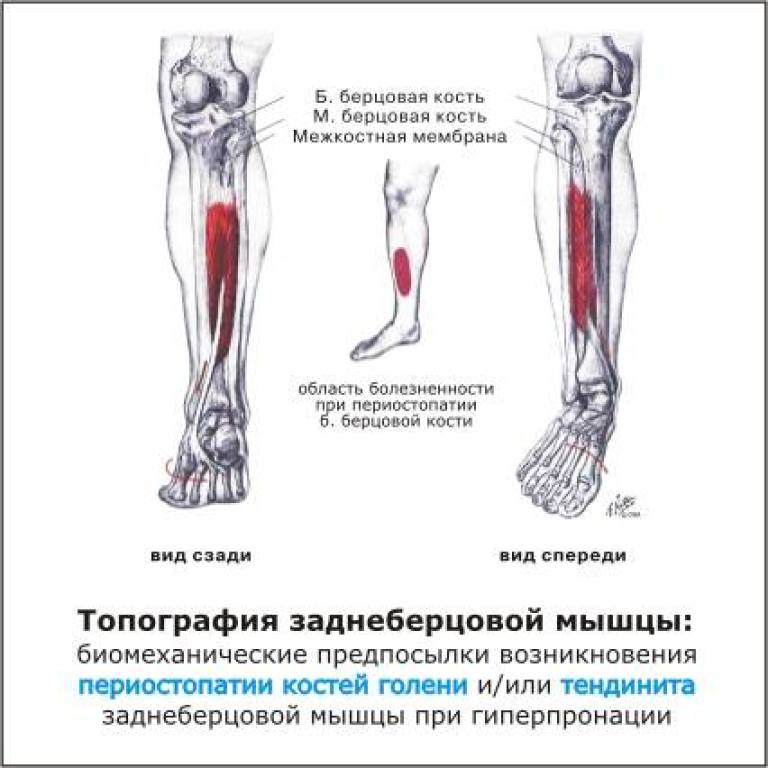 Немеет нога выше колена причины. Почему болят ноги в кости голени спереди. Болит нога сбоку от голени. Болит кость голени сбоку.