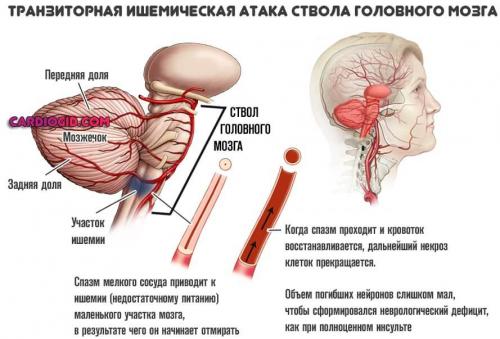 Влияние повышенного атмосферного давления на организм человека. Влияние низкого атмосферного давления на организм 